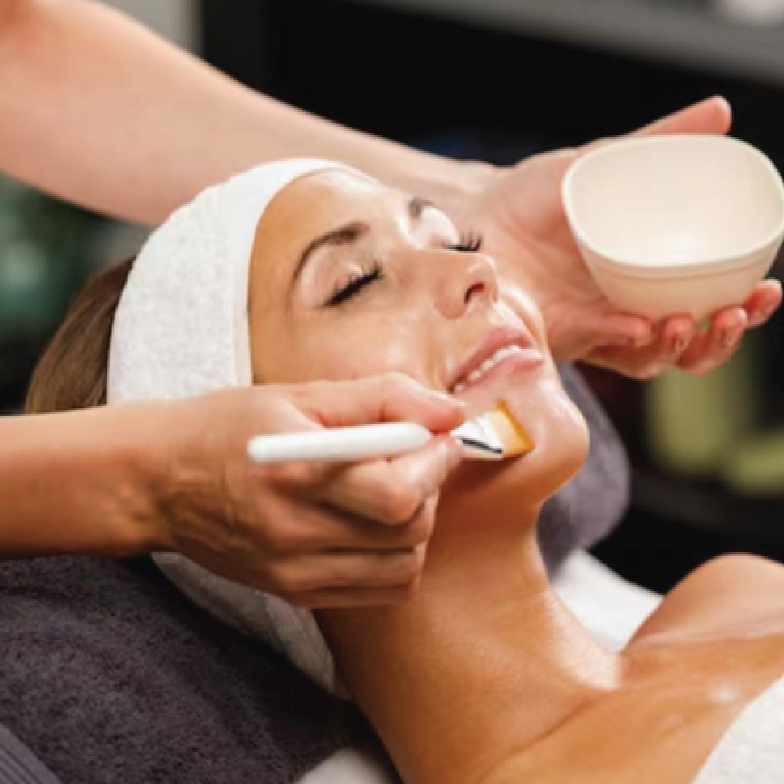 MISS MALINI - I Tried A Skin Renewal Peel