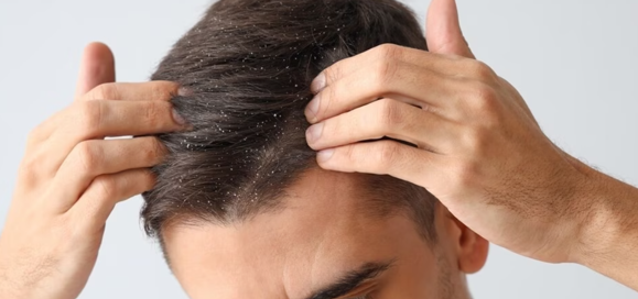 Scalp care is the new skin care, and it's time to care for our scalp, says a dermatologist